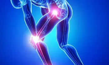 Mistaking Joint Pain for Fatigue: కీళ్ల నొప్పులను అలసట అనుకుని నిర్లక్ష్యం చేస్తున్నారా? ఇది ఆర్థరైటిస్.. ముందస్తు హెచ్చరిక కావచ్చు..