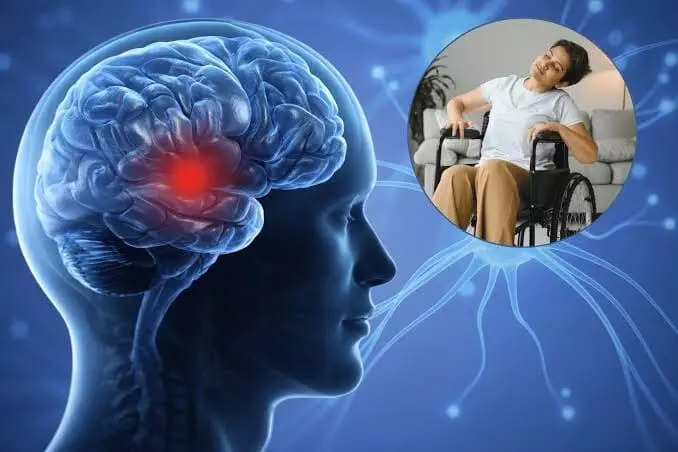 Rising Stroke Risk Among People Over 30: 30 దాటిన వారిలో పెరుగుతున్న పక్షవాతం ముప్పు.. యువతరం ఎందుకు జాగ్రత్తపడాలి? Rising Stroke Risk Among People Over 30: 30 దాటిన వారిలో పెరుగుతున్న పక్షవాతం ముప్పు.. యువతరం ఎందుకు జాగ్రత్తపడాలి?