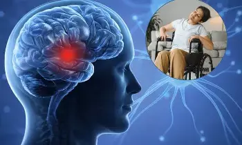 Rising Stroke Risk Among People Over 30: 30 దాటిన వారిలో పెరుగుతున్న పక్షవాతం ముప్పు.. యువతరం ఎందుకు జాగ్రత్తపడాలి? Rising Stroke Risk Among People Over 30: 30 దాటిన వారిలో పెరుగుతున్న పక్షవాతం ముప్పు.. యువతరం ఎందుకు జాగ్రత్తపడాలి?